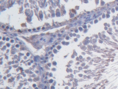 Fibulin 1 (FBLN1) Monoclonal Antibody - image 2