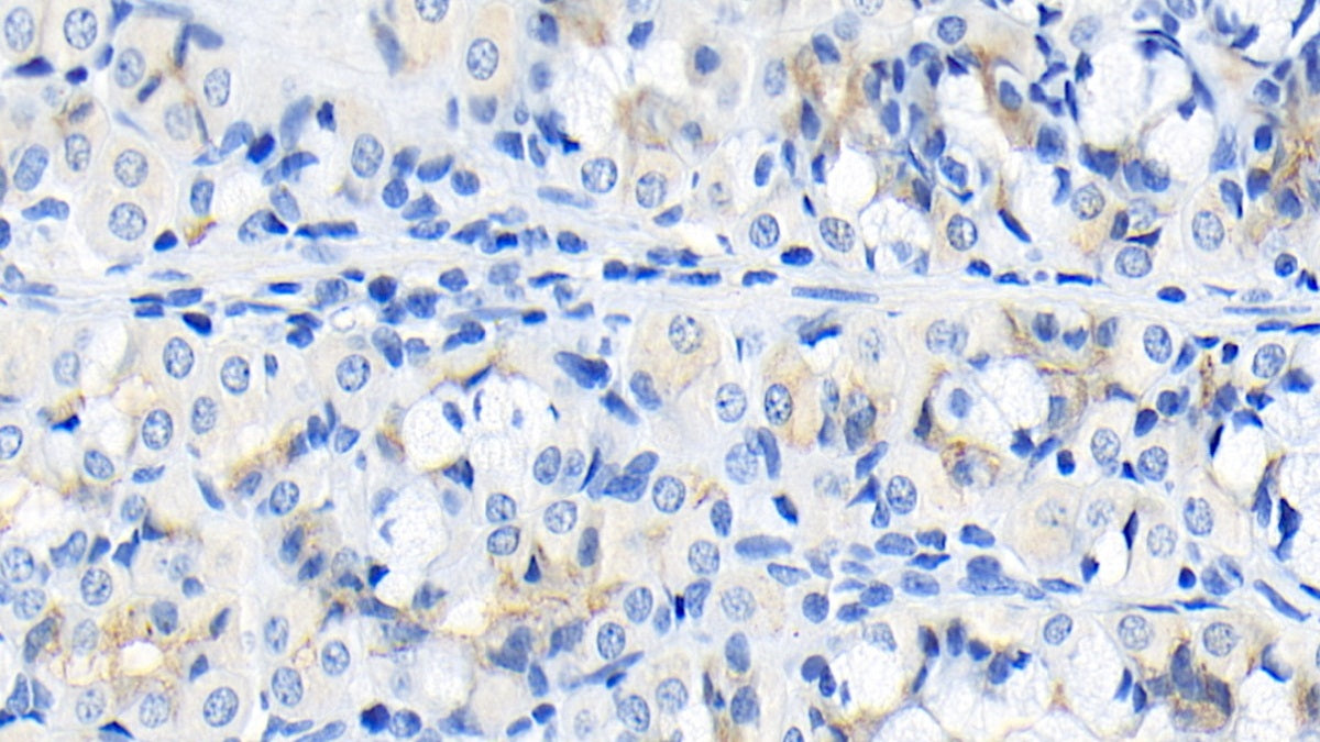 DAB staining on IHC-P; Sample: Human Kidney Tissue; Primary Ab: 20ug/ml Mouse Anti-Human FGF9 Antibody; Second Ab: 2ug/mL HRP-Linked Caprine Anti-Mouse IgG Polyclonal Antibody