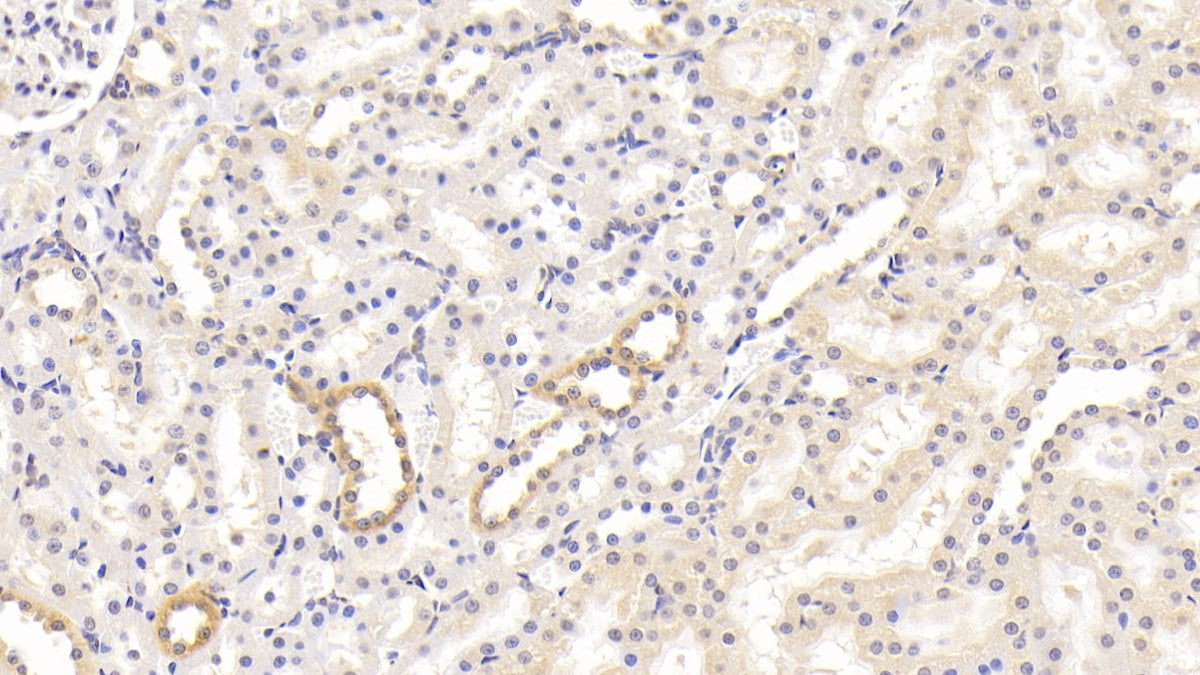 DAB staining on IHC-P; Sample: Rat Cardiac Muscle Tissue; Primary Ab: 30ug/ml Mouse Anti-Rat CD40L Antibody; Second Ab: 2ug/mL HRP-Linked Caprine Anti-Mouse IgG Polyclonal Antibody