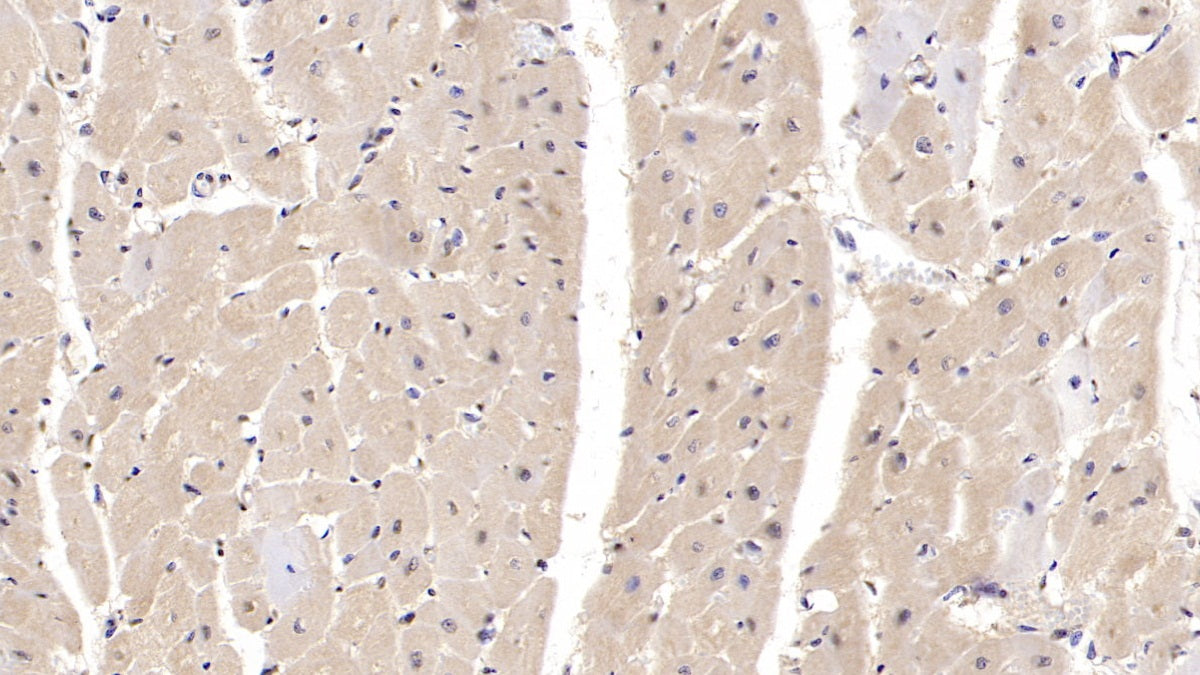 DAB staining on IHC-P; Samples: Porcine Lung Tissue; Primary Ab: 40ug/ml Mouse Anti-Porcine IL6 Antibody; Second Ab: 2ug/mL HRP-Linked Caprine Anti-Mouse IgG Polyclonal Antibody