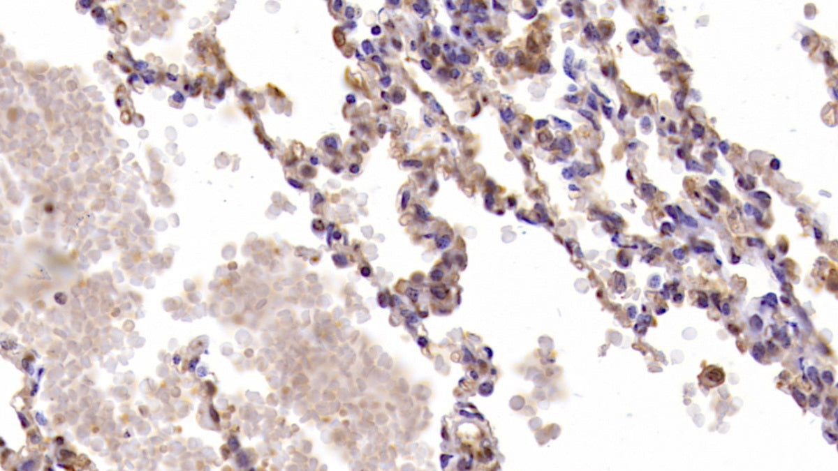 Interleukin 6 (IL6) Monoclonal Antibody - image 3