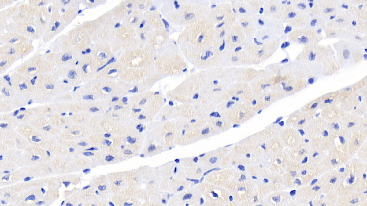 DAB staining on IHC-P; Sample: Human Stomach Tissue; Primary Ab: 20ug/ml Mouse Anti-Human ACVR2A Antibody; Second Ab: 2ug/mL HRP-Linked Caprine Anti-Mouse IgG Polyclonal Antibody