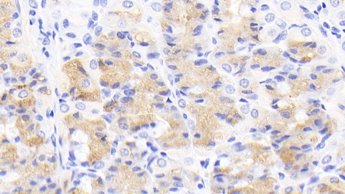 Western Blot; Sample: Porcine Skeletal muscle lysate Primary Ab: 2ug/ml Mouse Anti-Human ACVR2A Antibody Second Ab: 0.2ug/mL HRP-Linked Caprine Anti-Mouse IgG Polyclonal Antibody
