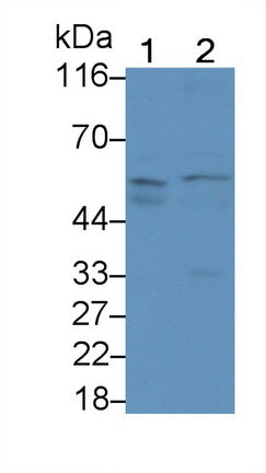 Activin A Receptor Type II A (ACVR2A) Monoclonal Antibody - image 2
