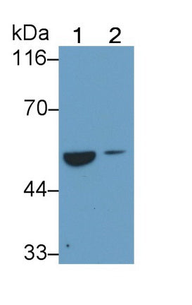 Alanine Aminotransferase (ALT) Monoclonal Antibody - image 2