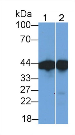 Creatine Kinase B (CK-BB) Monoclonal Antibody - image 2