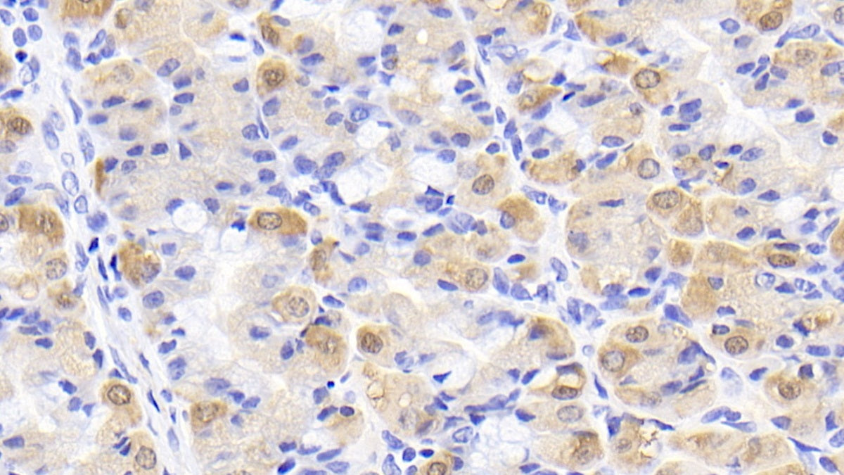 DAB staining on IHC-P; Sample: Human Cardiac Muscle Tissue; Primary Ab: 20ug/ml Mouse Anti-Human CK-BB Antibody; Second Ab: 2ug/mL HRP-Linked Caprine Anti-Mouse IgG Polyclonal Antibody