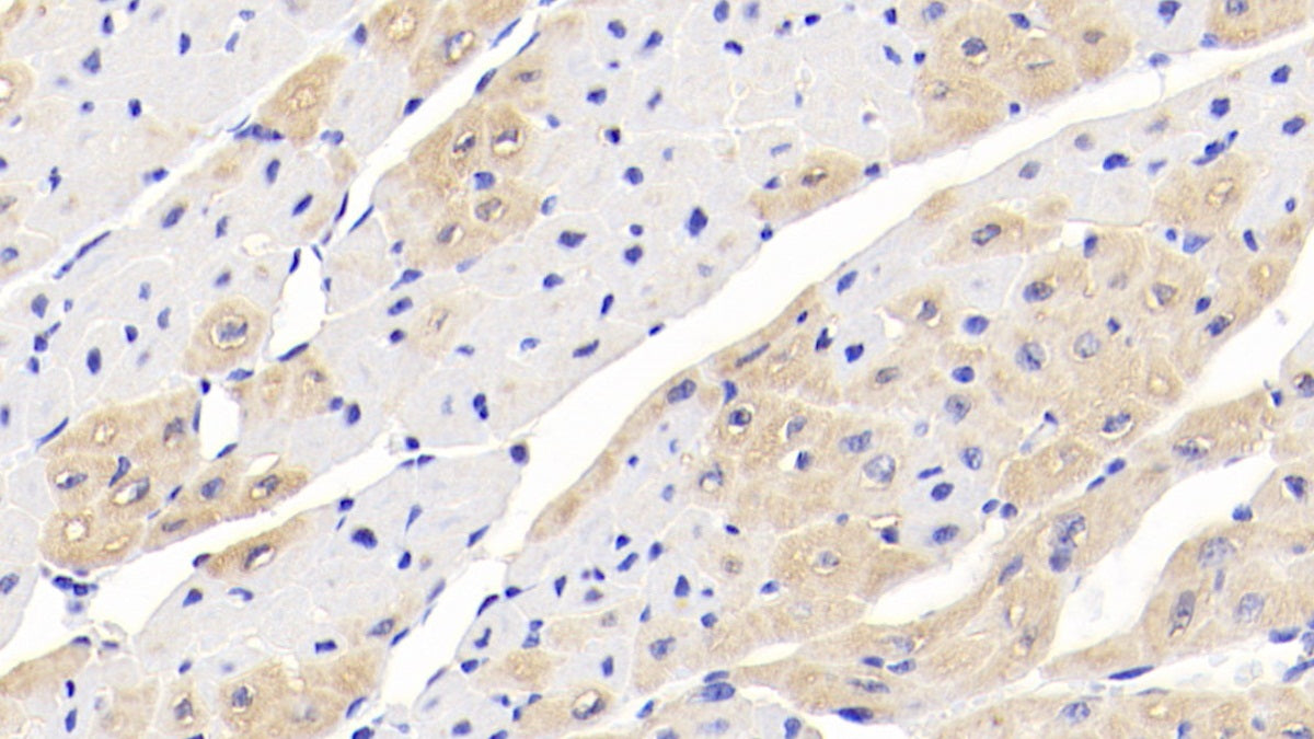 DAB staining on IHC-P; Sample: Human Cerebrum Tissue; Primary Ab: 20ug/ml Mouse Anti-Human CK-BB Antibody; Second Ab: 2ug/mL HRP-Linked Caprine Anti-Mouse IgG Polyclonal Antibody