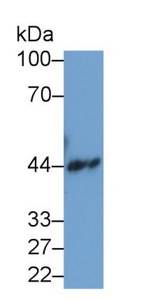 Creatine Kinase B (CK-BB) Monoclonal Antibody - image 5