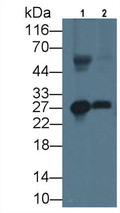 Apolipoprotein A1 (APOA1) Monoclonal Antibody - image 2