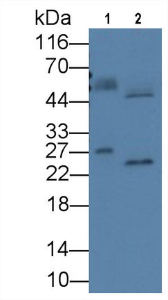 Alpha-1-Acid Glycoprotein (a1AGP) Monoclonal Antibody - image 3