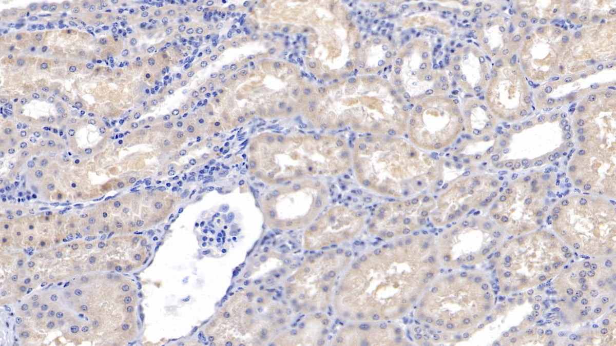 DAB staining on IHC-P; Samples: Human Liver Tissue; Primary Ab: 10ug/ml Mouse Anti-Human ACVR2A Antibody; Second Ab: 2ug/mL HRP-Linked Caprine Anti-Mouse IgG Polyclonal Antibody