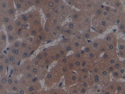 DAB staining on IHC-P; Samples: Porcine Liver Tissue; Primary Ab: 40ug/ml Mouse Anti-Human ALT Antibody; Second Ab: 2ug/mL HRP-Linked Caprine Anti-Mouse IgG Polyclonal Antibody