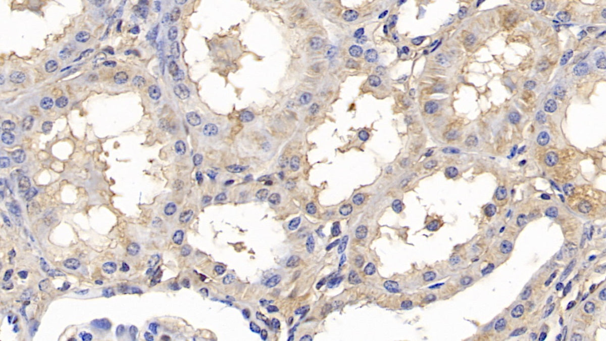 Alanine Aminotransferase (ALT) Monoclonal Antibody - image 4