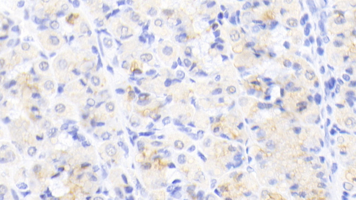 DAB staining on IHC-P; Sample: Human Cardiac Muscle Tissue; Primary Ab: 20ug/ml Mouse Anti-Human ACVR2A Antibody; Second Ab: 2ug/mL HRP-Linked Caprine Anti-Mouse IgG Polyclonal Antibody