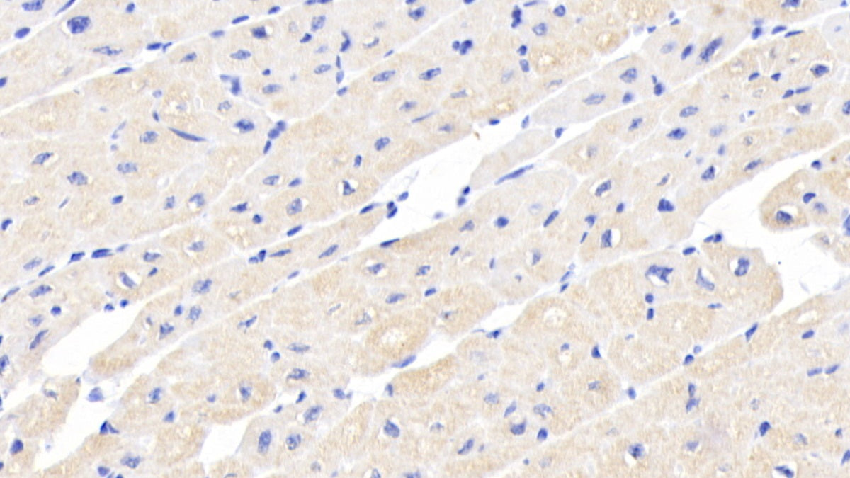 Activin A Receptor Type II A (ACVR2A) Monoclonal Antibody - image 3