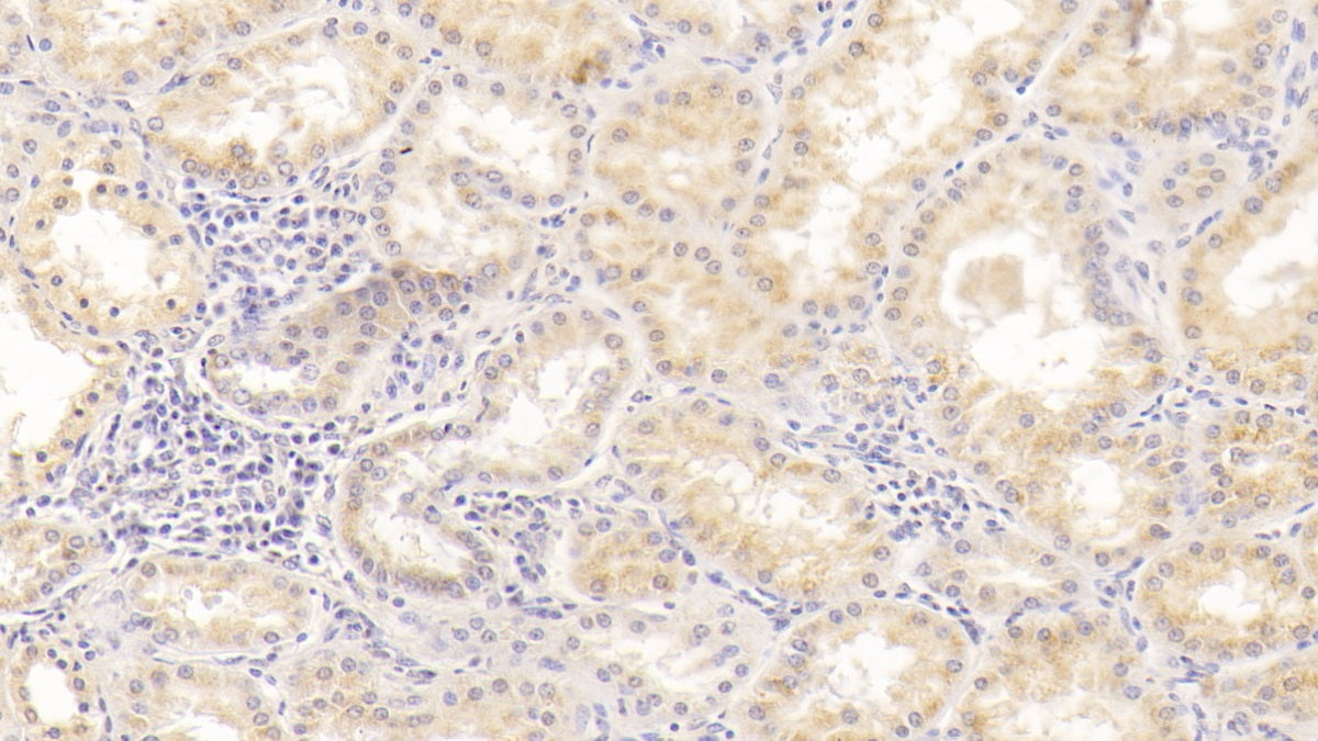 DAB staining on IHC-P; Sample: Human Liver Tissue; Primary Ab: 20ug/ml Mouse Anti-Human ALT Antibody; Second Ab: 2ug/mL HRP-Linked Caprine Anti-Mouse IgG Polyclonal Antibody