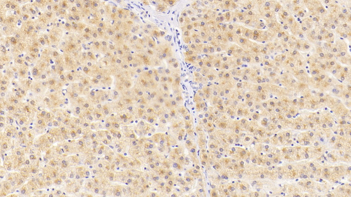 Alanine Aminotransferase (ALT) Monoclonal Antibody - image 3