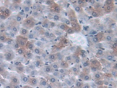 DAB staining on IHC-P; Sample: Rat Liver Tissue; Primary Ab: 30ug/ml Mouse Anti-Rat a1AGP Antibody; Control: Used PBS instead of primary antibody; Second Ab: 2ug/ml HRP-Linked Caprine Anti-Mouse IgG Polyclonal Antibody