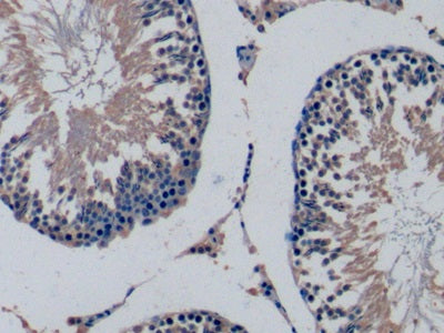 DAB staining on IHC-P; Sample: Rat Kidney Tissue; Primary Ab: 10ug/ml Mouse Anti-Rat FGF15 Antibody; Second Ab: 2ug/mL HRP-Linked Caprine Anti-Mouse IgG Polyclonal Antibody