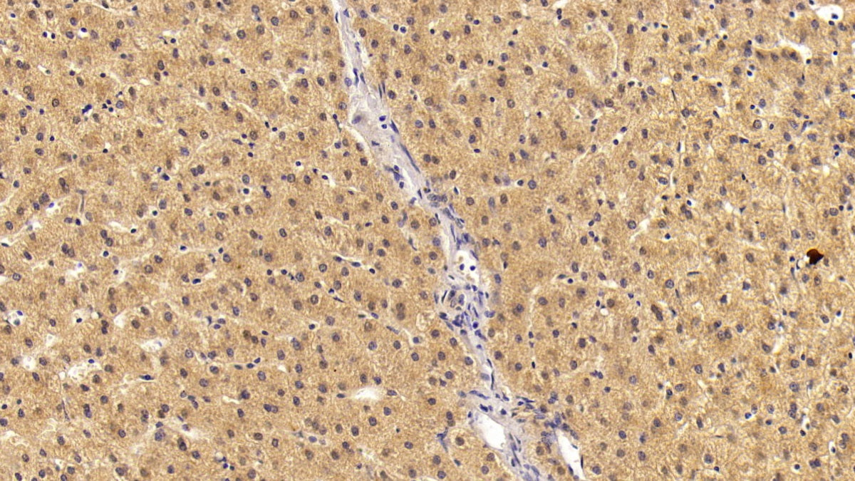 Angiostatin (ANG) Monoclonal Antibody - image 2