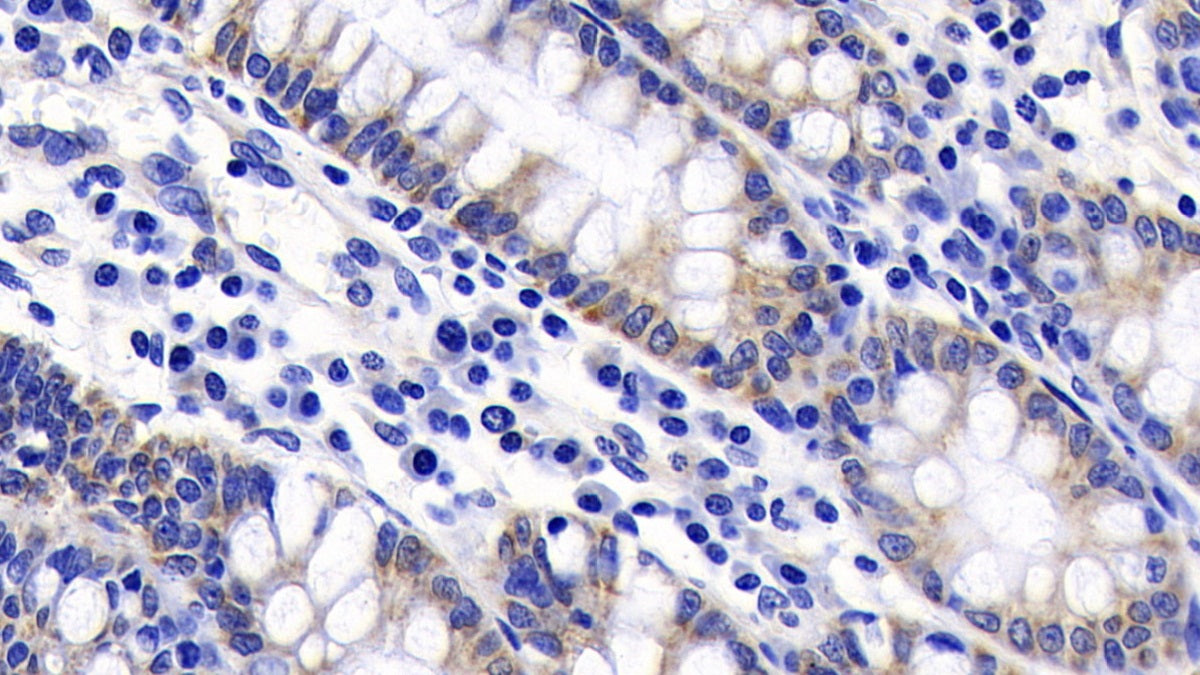 DAB staining on IHC-P; Sample: Human Kidney Tissue; Primary Ab: 20ug/ml Mouse Anti-Human CASP9 Antibody; Second Ab: 2ug/mL HRP-Linked Caprine Anti-Mouse IgG Polyclonal Antibody