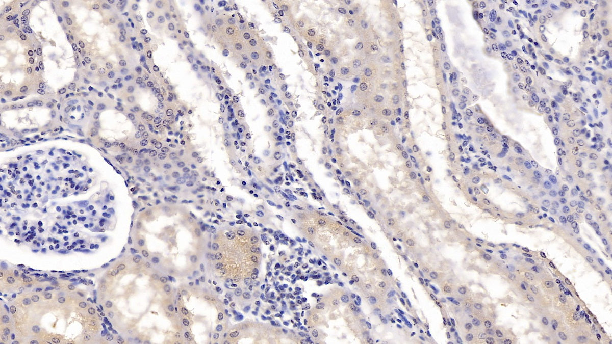 DAB staining on IHC-P; Sample: Human Liver Tissue; Primary Ab: 10ug/ml Mouse Anti-Human KPNa2 Antibody; Second Ab: 2ug/mL HRP-Linked Caprine Anti-Mouse IgG Polyclonal Antibody
