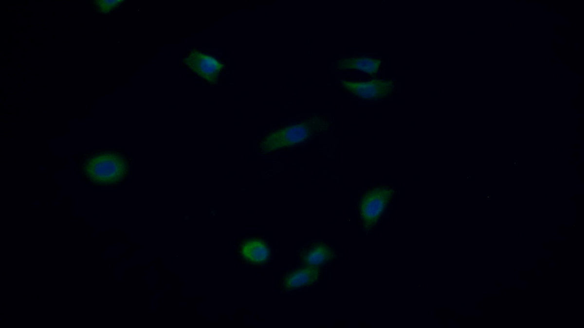 Western Blot; Sample: Hela cell lysate Primary Ab: 2ug/ml Mouse Anti-Human SQSTM1 Antibody Second Ab: 0.2ug/mL HRP-Linked Caprine Anti-Mouse IgG Polyclonal Antibody