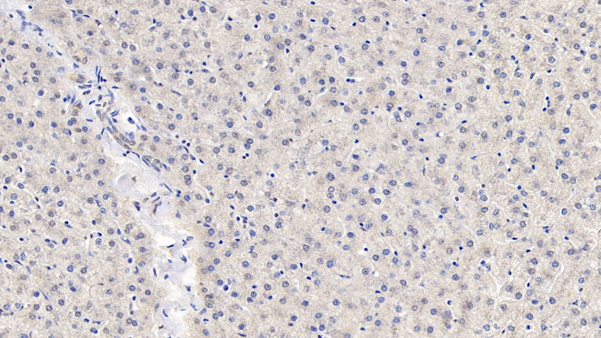 Angiopoietin Like Protein 8 (ANGPTL8) Monoclonal Antibody - image 2