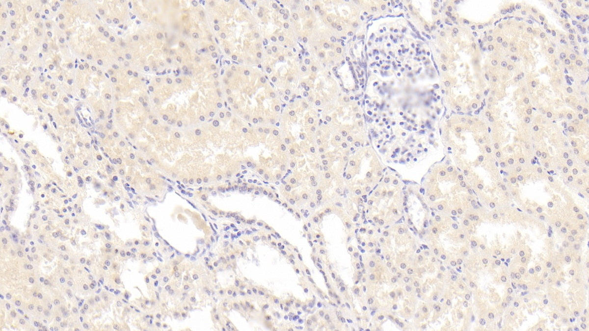 Semaphorin 3A (SEMA3A) Monoclonal Antibody - image 3