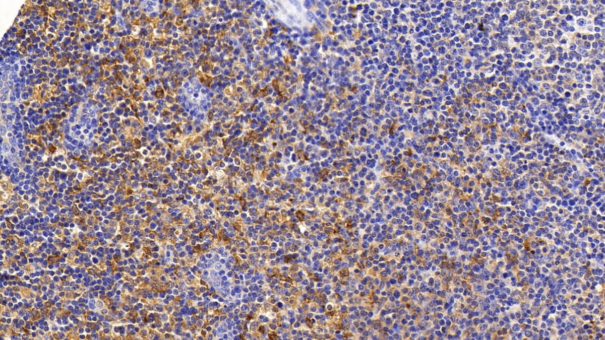 Sequestosome 1 (SQSTM1) Monoclonal Antibody - image 3