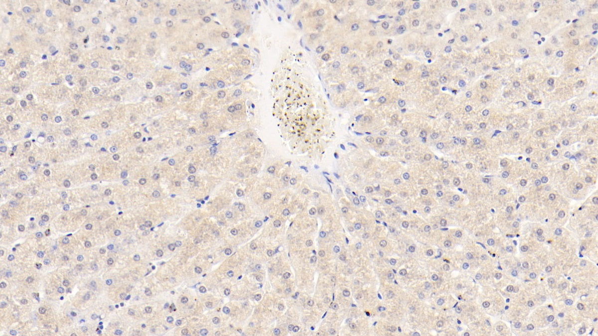 Angiopoietin Like Protein 8 (ANGPTL8) Monoclonal Antibody - image 2