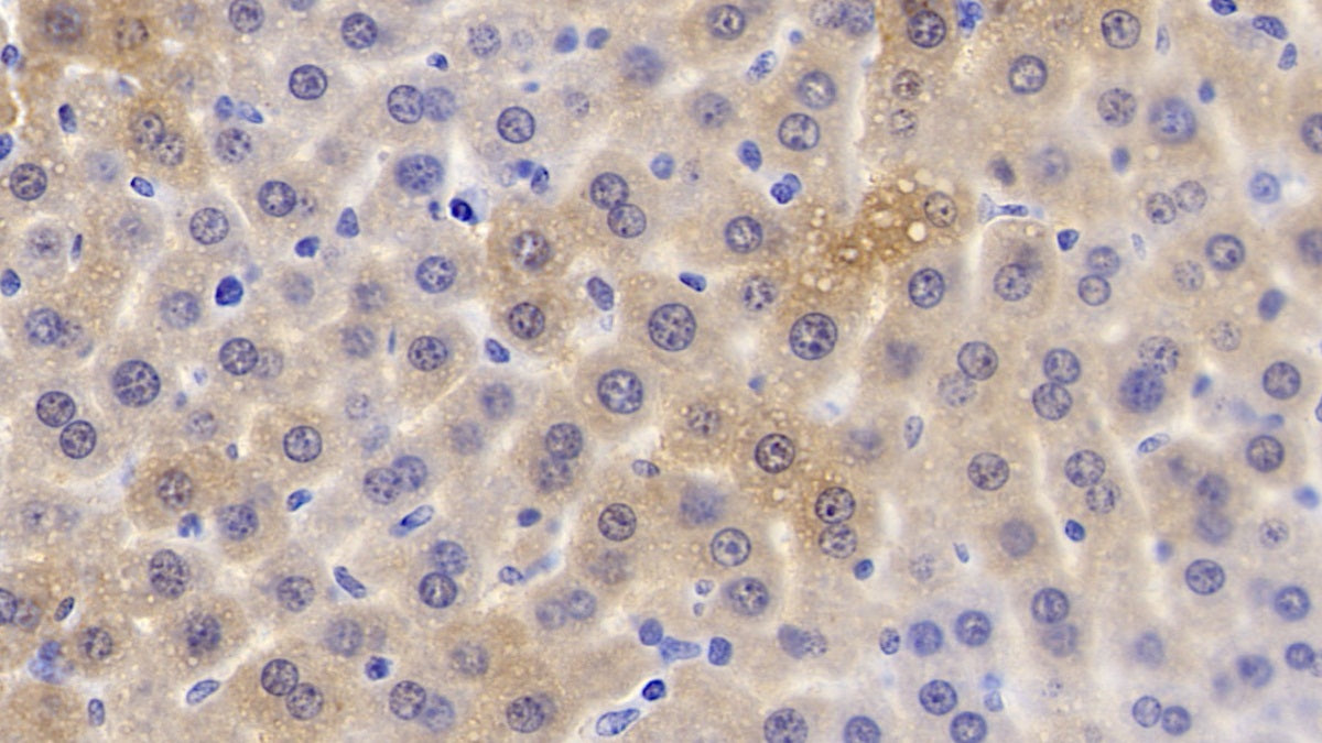Apolipoprotein C1 (APOC1) Monoclonal Antibody - image 2