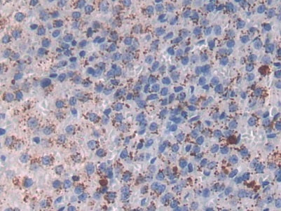Major Basic Protein (MBP) Monoclonal Antibody - image 2