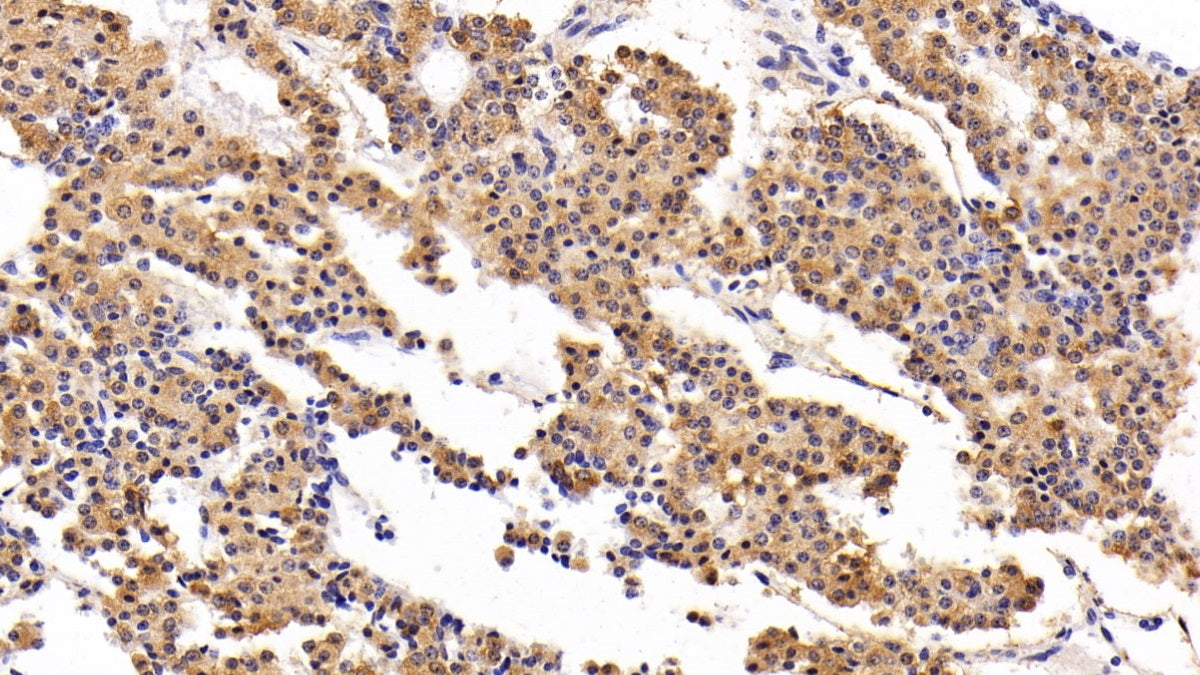 AF488 staining on IF; Sample: Hela cell; Primary Ab: 20ug/ml Mouse Anti-Human PRL Antibody; Second Ab: 2ug/ml AF488-Linked Caprine Anti-Mouse IgG Polyclonal Antibody
