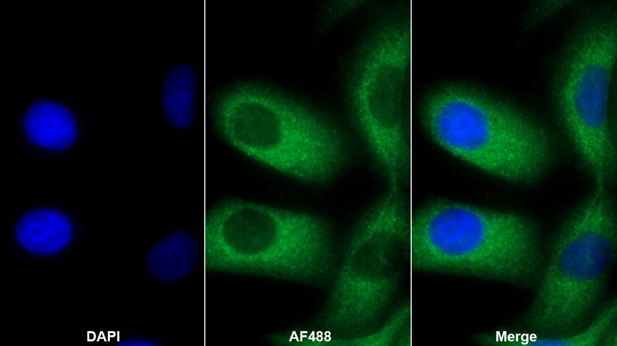 Prolactin (PRL) Monoclonal Antibody - image 3