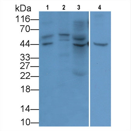 Glypican 3 (GPC3) Monoclonal Antibody - image 2