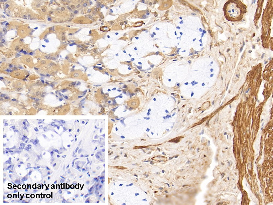 DAB staining on IHC-P; Sample: Human Cardiac Muscle Tissue; Primary Ab: 10ug/ml Mouse Anti-Human ACTC1 Antibody; Second Ab: 2ug/mL HRP-Linked Caprine Anti-Mouse IgG Polyclonal Antibody