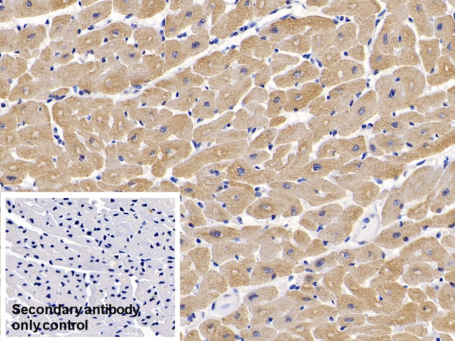 DAB staining on IHC-P; Sample: Human Small intestine Tissue; Primary Ab: 10ug/ml Mouse Anti-Human ACTC1 Antibody; Second Ab: 2ug/mL HRP-Linked Caprine Anti-Mouse IgG Polyclonal Antibody