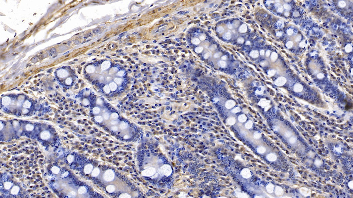 DAB staining on IHC-P; Sample: Human Colon Tissue; Primary Ab: 10ug/ml Mouse Anti-Human ACTC1 Antibody; Second Ab: 2ug/mL HRP-Linked Caprine Anti-Mouse IgG Polyclonal Antibody