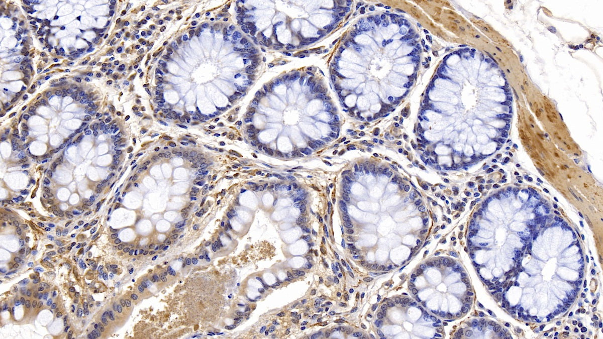 Actin Alpha 1, Cardiac Muscle (Anti-ACTC1) Monoclonal Antibody - image 5