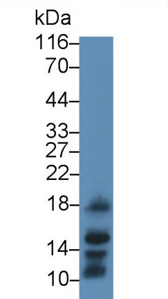 Procalcitonin (PCT) Monoclonal Antibody - image 2