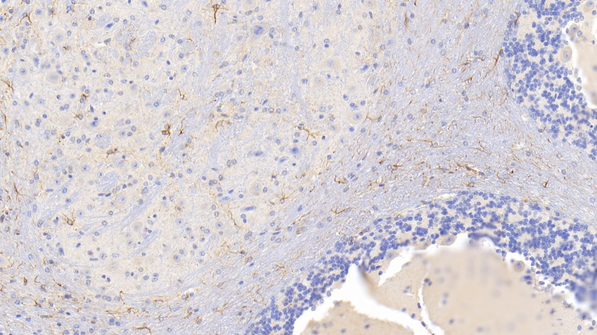 DAB staining on IHC-P; Sample: Mouse Spinal cord Tissue; Primary Ab: 20ug/ml Mouse Anti-Mouse GFAP Antibody; Second Ab: 2ug/mL HRP-Linked Caprine Anti-Mouse IgG Polyclonal Antibody
