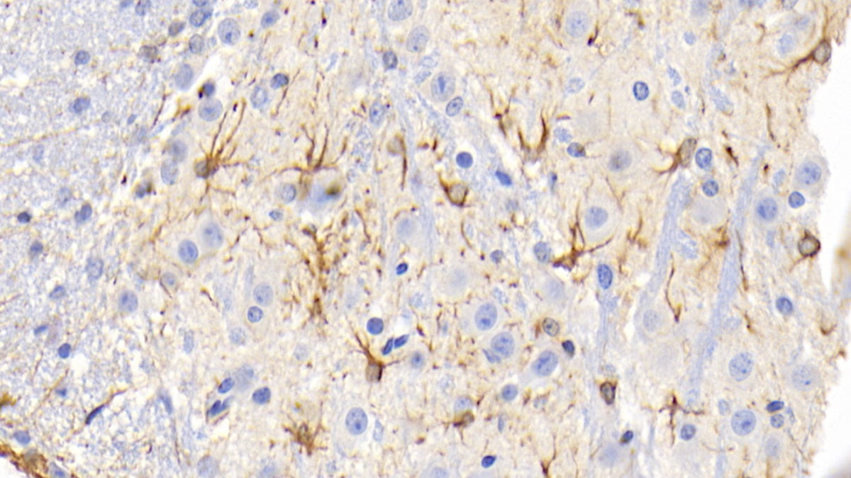 DAB staining on IHC-P; Sample: Mouse Cerebrum Tissue; Primary Ab: 20ug/ml Mouse Anti-Mouse GFAP Antibody; Second Ab: 2ug/mL HRP-Linked Caprine Anti-Mouse IgG Polyclonal Antibody