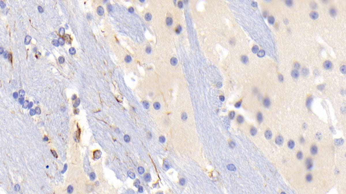 DAB staining on IHC-P; Sample: Mouse Cerebrum Tissue; Primary Ab: 20ug/ml Mouse Anti-Mouse GFAP Antibody; Control: Used PBS instead of primary antibody; Second Ab: 2ug/ml HRP-Linked Caprine Anti-Mouse IgG Polyclonal Antibody