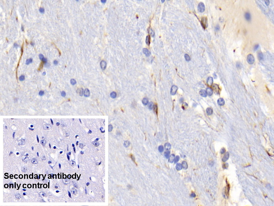 Glial Fibrillary Acidic Protein (GFAP) Monoclonal Antibody - image 5