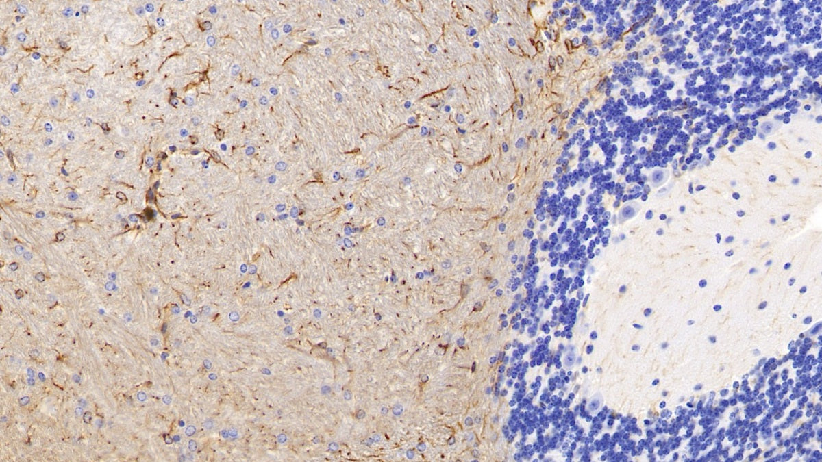 DAB staining on IHC-P; Sample: Mouse Cerebrum Tissue; Primary Ab: 30ug/ml Mouse Anti-Mouse GFAP Antibody; Second Ab: 2ug/mL HRP-Linked Caprine Anti-Mouse IgG Polyclonal Antibody