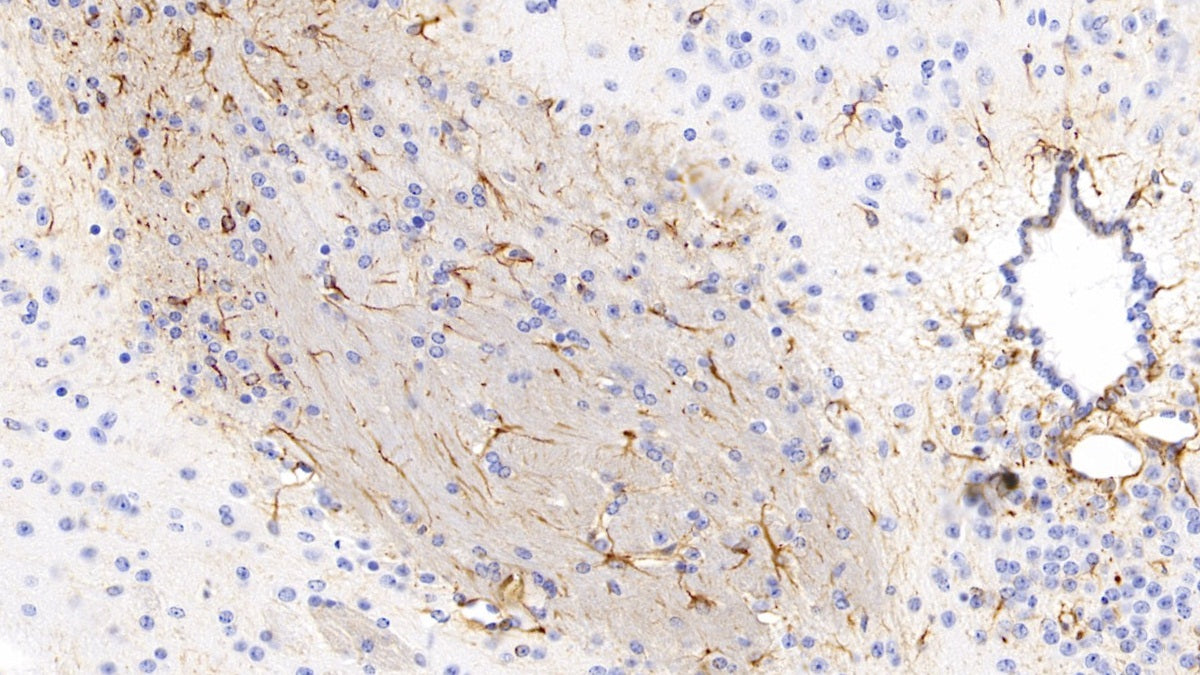 DAB staining on IHC-P; Sample: Mouse Cerebrum Tissue; Primary Ab: 30ug/ml Mouse Anti-Mouse GFAP Antibody; Control: Used PBS instead of primary antibody; Second Ab: 2ug/ml HRP-Linked Caprine Anti-Mouse IgG Polyclonal Antibody