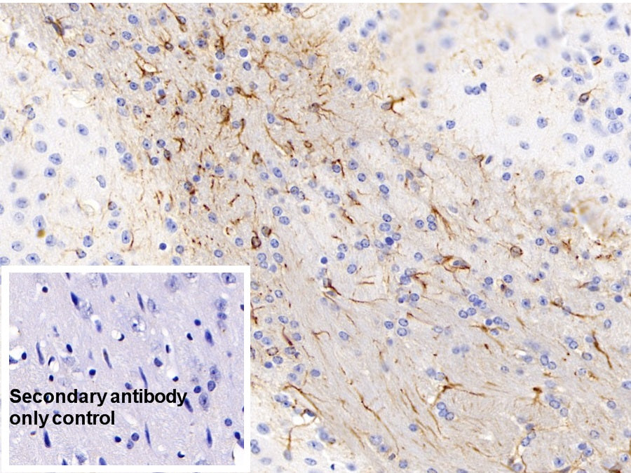DAB staining on IHC-P; Sample: Mouse Cerebellum Tissue; Primary Ab: 30ug/ml Mouse Anti-Mouse GFAP Antibody; Control: Used PBS instead of primary antibody; Second Ab: 2ug/ml HRP-Linked Caprine Anti-Mouse IgG Polyclonal Antibody