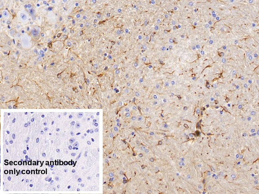 Glial Fibrillary Acidic Protein (GFAP) Monoclonal Antibody - image 5